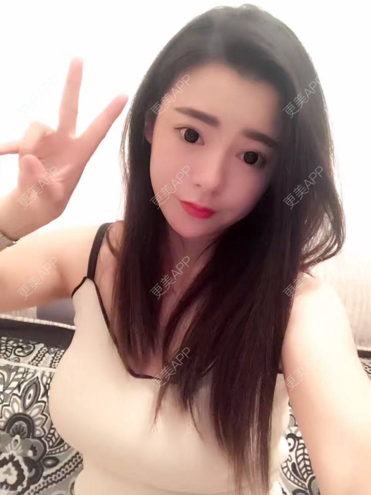 更美 - 初秋繁华落尽的假体隆胸经验 | 丰胸（隆胸） | 假体隆胸 | 南京