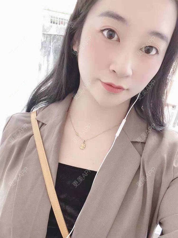 更美 - 更美用户129LF9Yh6a的玻尿酸下巴经验 | 视频日记 | 玻尿酸下巴 | 广州