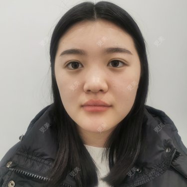 软耳兔兔1