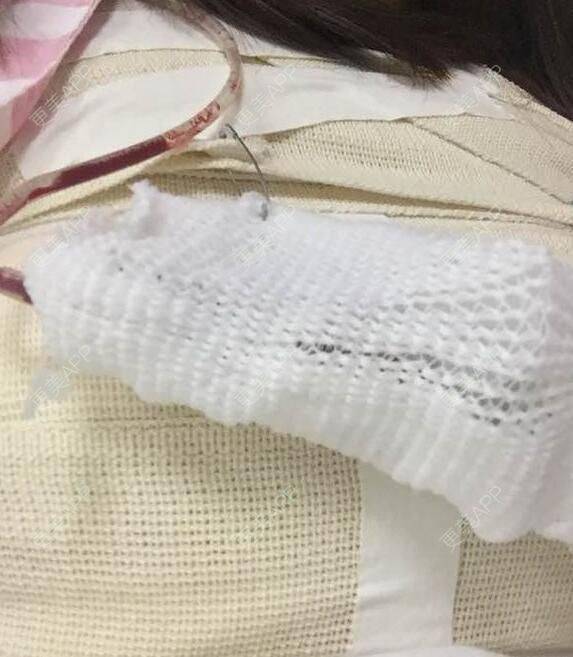 更美 - 美美你的的假体隆胸经验 | 假体隆胸 | 南京