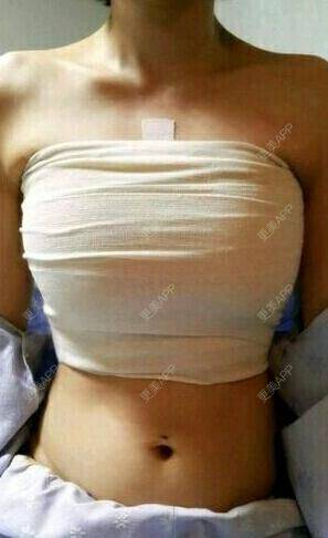 更美 - 美美你的的假体隆胸经验 | 假体隆胸 | 南京