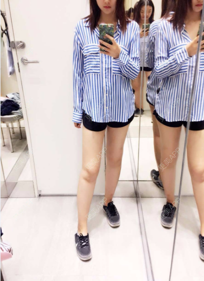 吸脂瘦大腿前后对比照_更美用户ymrydnakjt吸脂瘦大腿前后对比照_术后