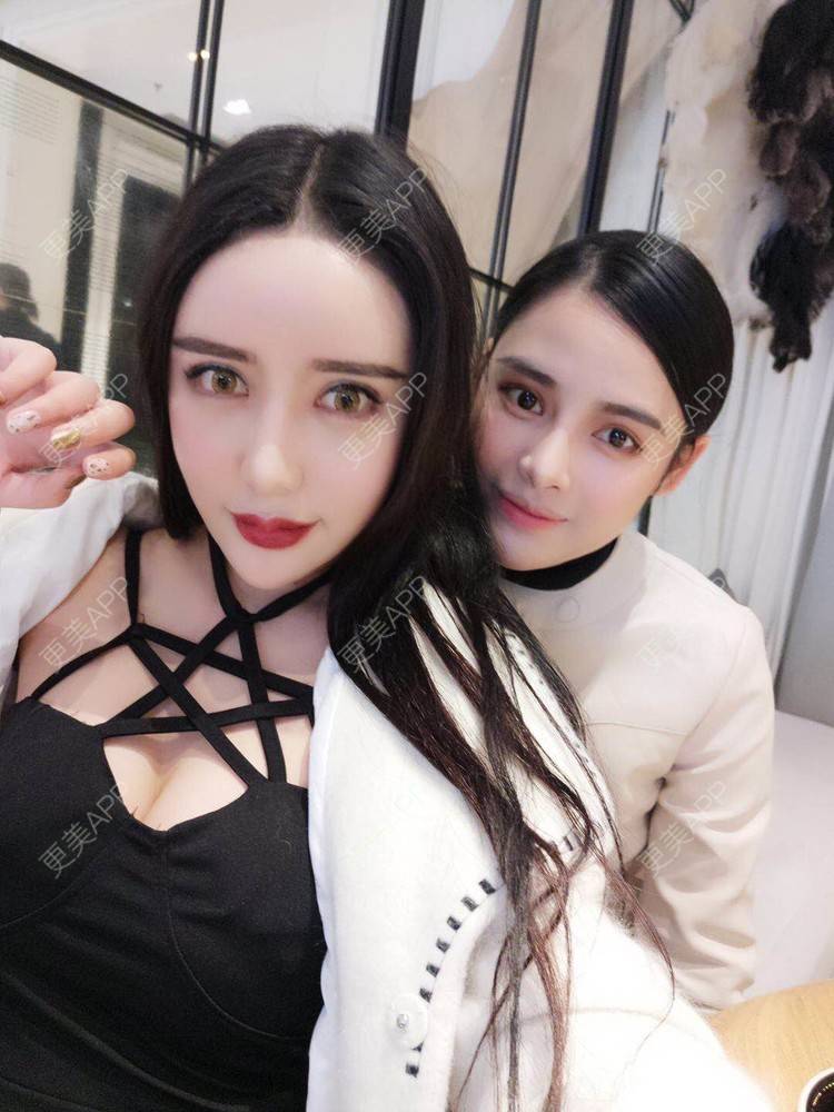 更美 - 美美你的的假体隆胸经验 | 丰胸（隆胸） | 假体隆胸 | 南京