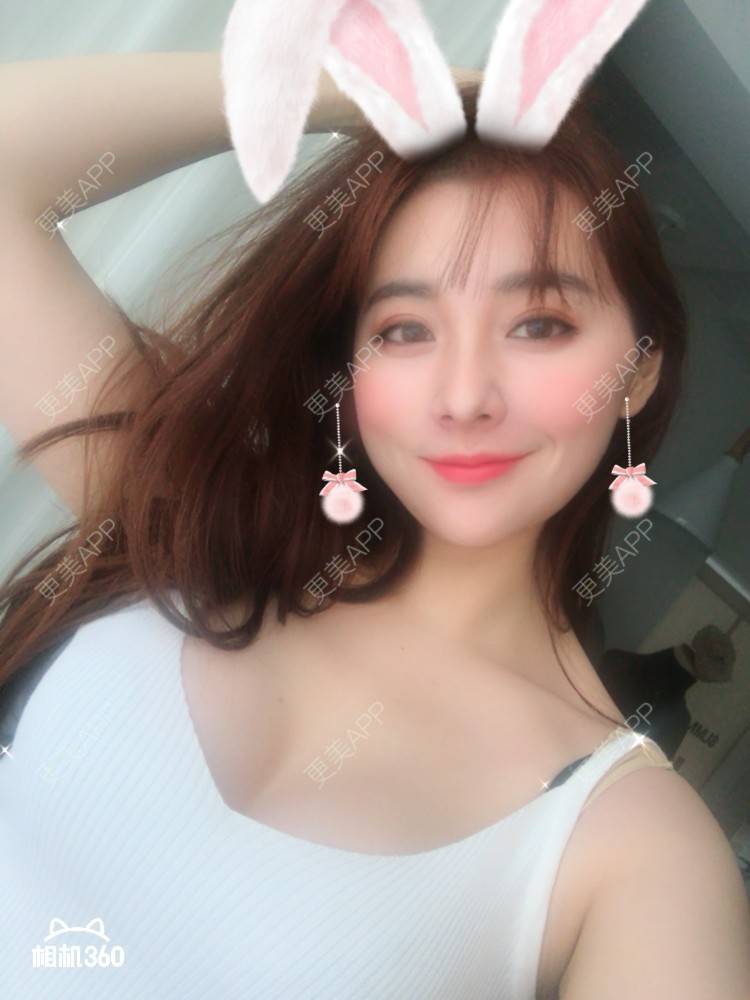 自体脂肪隆胸效果图_流星雨fome_术后643天__更美