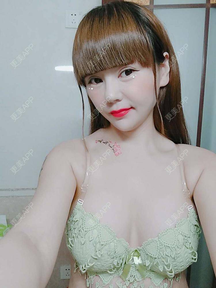 更美 - 更美用户CQ7WrXWLlK的乳房再造经验 | 乳房再造 | 假体隆胸 | 美胸套餐 | 重庆