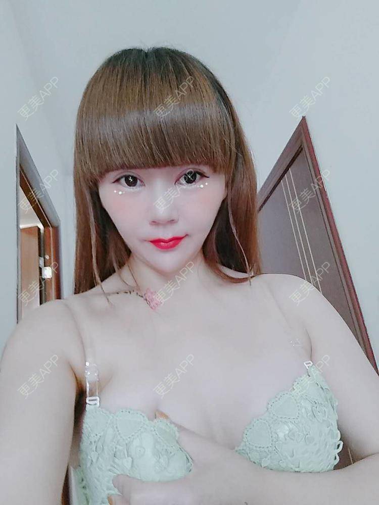 更美 - 更美用户CQ7WrXWLlK的乳房再造经验 | 乳房再造 | 假体隆胸 | 美胸套餐 | 重庆