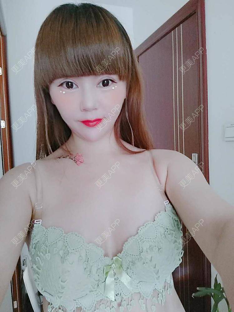 更美 - 更美用户CQ7WrXWLlK的乳房再造经验 | 乳房再造 | 假体隆胸 | 美胸套餐 | 重庆