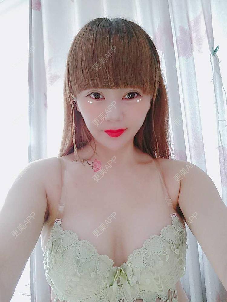 更美 - 更美用户CQ7WrXWLlK的乳房再造经验 | 乳房再造 | 假体隆胸 | 美胸套餐 | 重庆