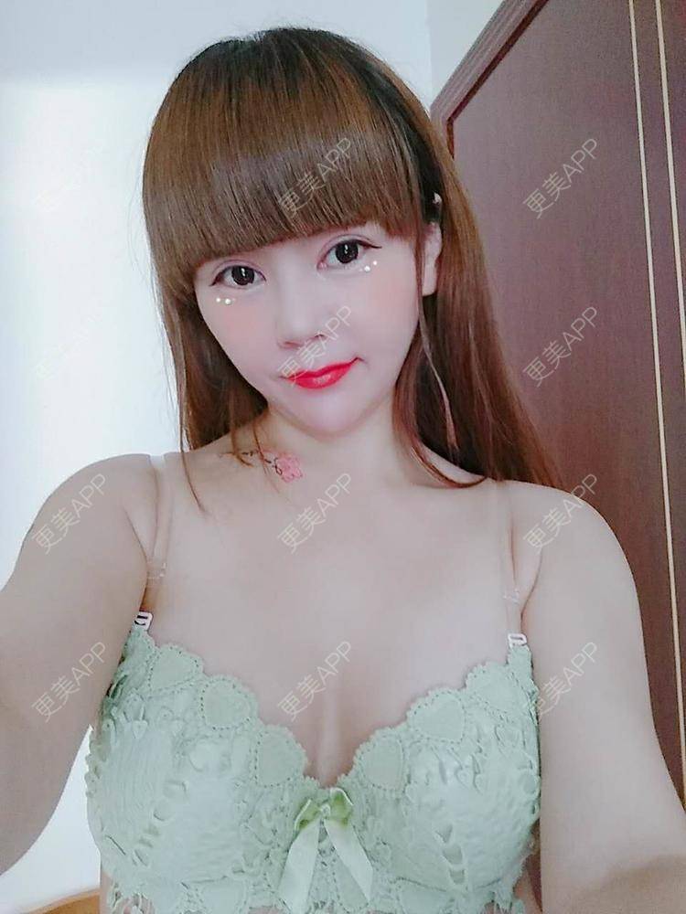 更美 - 更美用户CQ7WrXWLlK的乳房再造经验 | 乳房再造 | 假体隆胸 | 美胸套餐 | 重庆