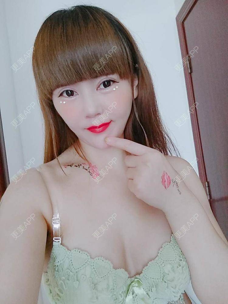 更美 - 更美用户CQ7WrXWLlK的乳房再造经验 | 乳房再造 | 假体隆胸 | 美胸套餐 | 重庆