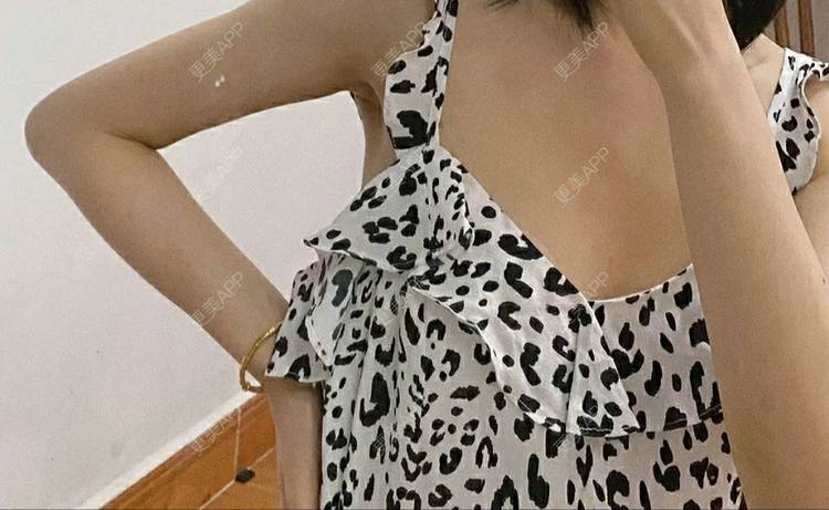 更美 - 拼命十三妹i不的吸脂去副乳经验 | 吸脂去副乳 | 广州