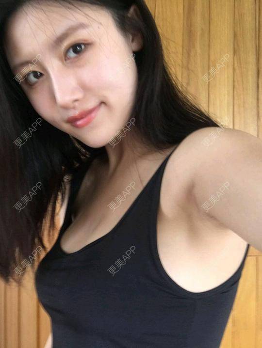 喵了个kitty的自体脂肪隆胸日记