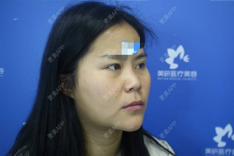 更美 - 更美用户zwQN5e8jIh的鼻部多项经验 | 鼻部多项 | 长沙