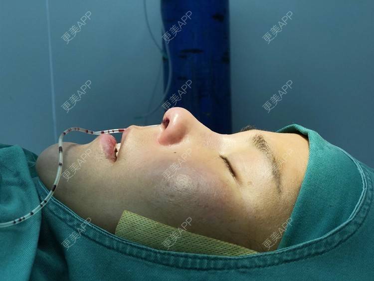 更美 - 更美用户zwQN5e8jIh的鼻部多项经验 | 鼻部多项 | 长沙