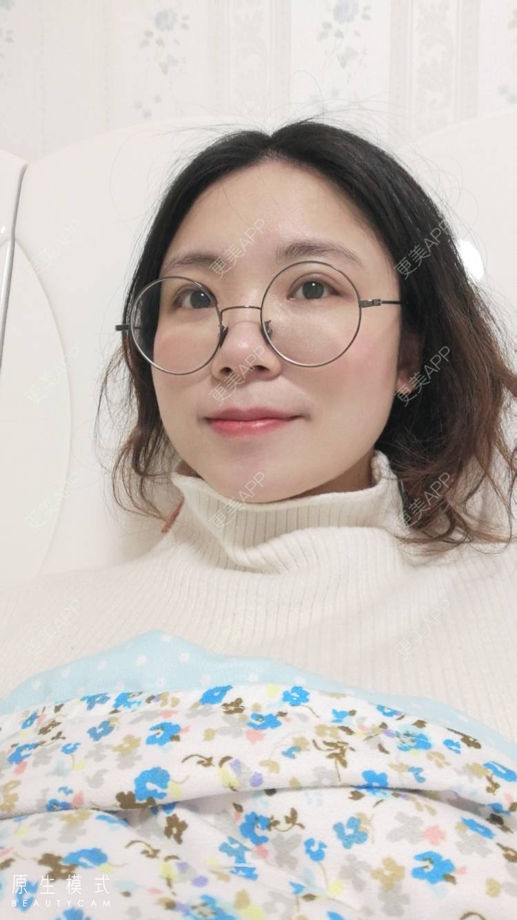 更美 - 墨七轩的双眼皮经验 | 双眼皮 | 全切双眼皮 | 开内眼角 | 开外眼角 | 杭州