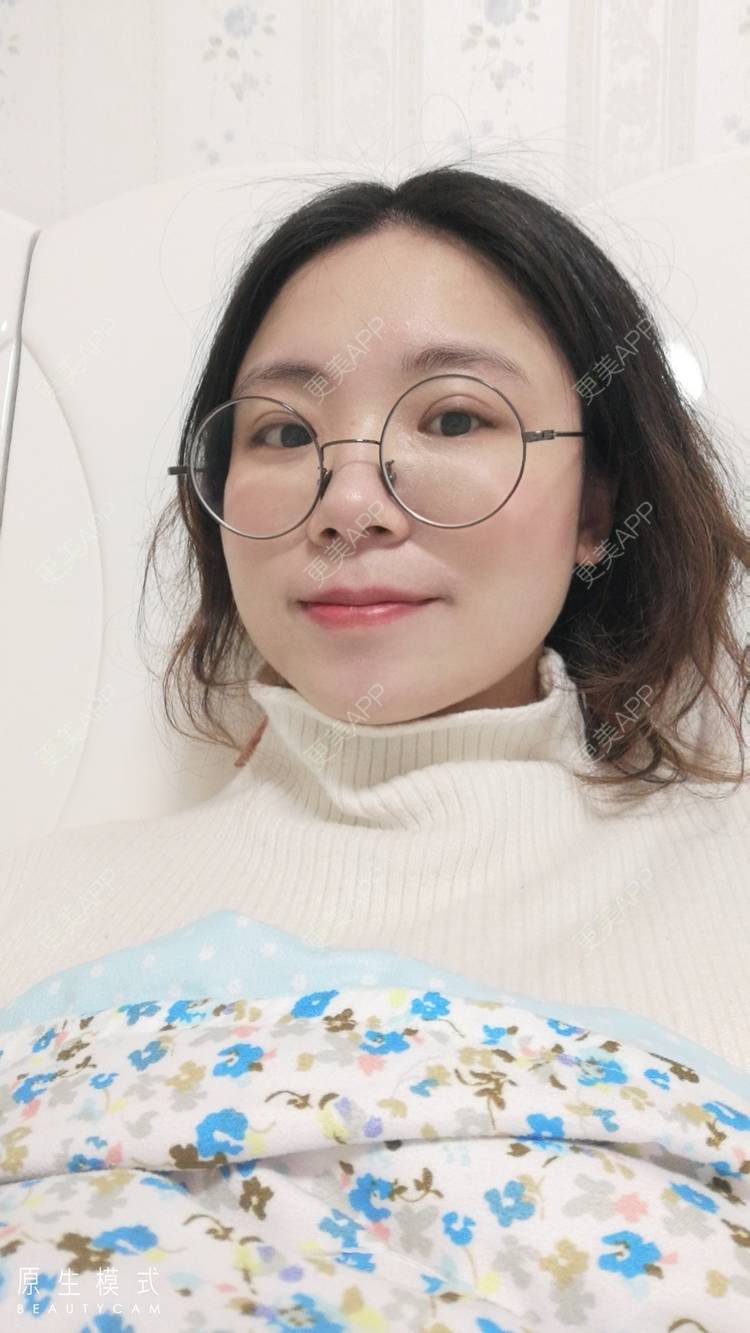 更美 - 墨七轩的双眼皮经验 | 双眼皮 | 全切双眼皮 | 开内眼角 | 开外眼角 | 杭州