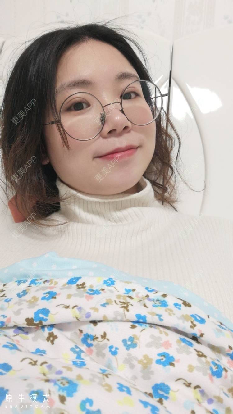 更美 - 墨七轩的双眼皮经验 | 双眼皮 | 全切双眼皮 | 开内眼角 | 开外眼角 | 杭州