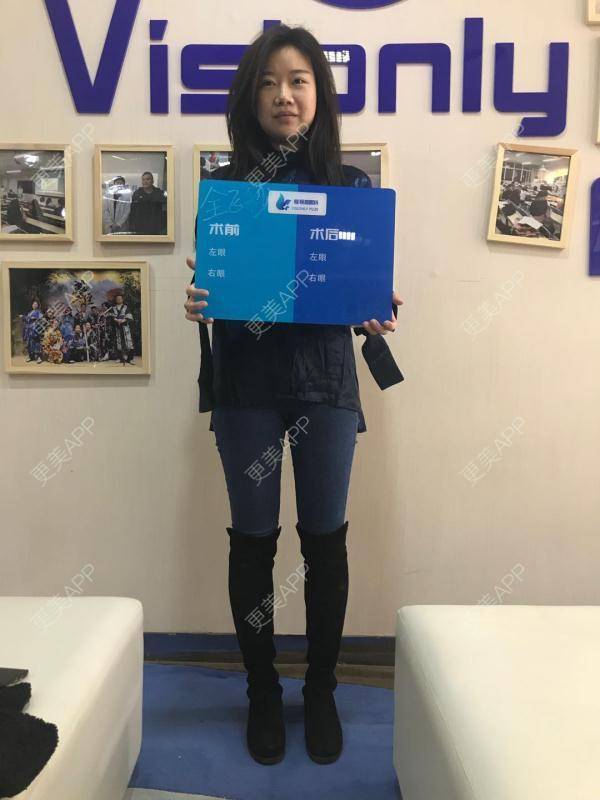 更美 - 花花1～的激光屈光性角膜切削术经验 | 全飞秒激光术 | 激光屈光性角膜切削术 | 北京