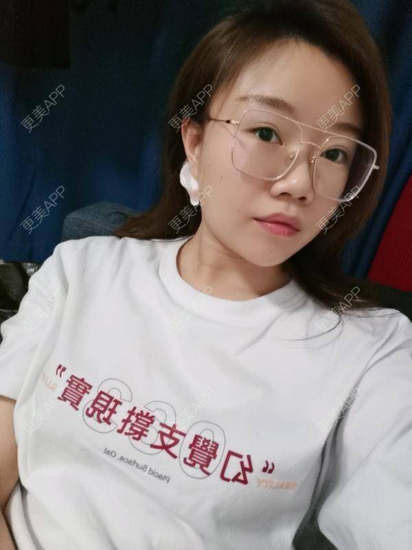 更美 - 花花1～的激光屈光性角膜切削术经验 | 全飞秒激光术 | 激光屈光性角膜切削术 | 北京