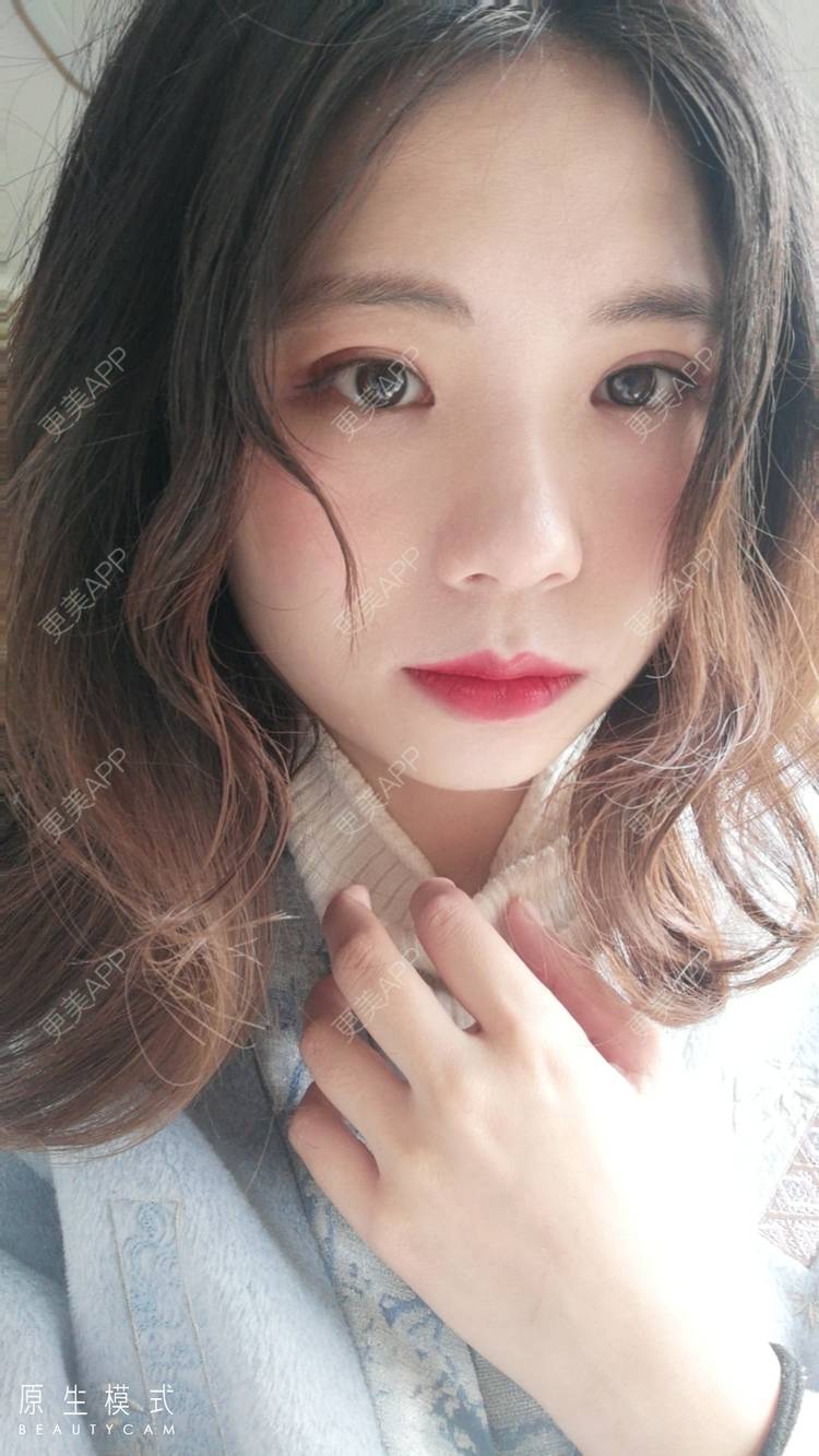 更美 - 墨七轩的双眼皮经验 | 双眼皮 | 全切双眼皮 | 开内眼角 | 开外眼角 | 杭州