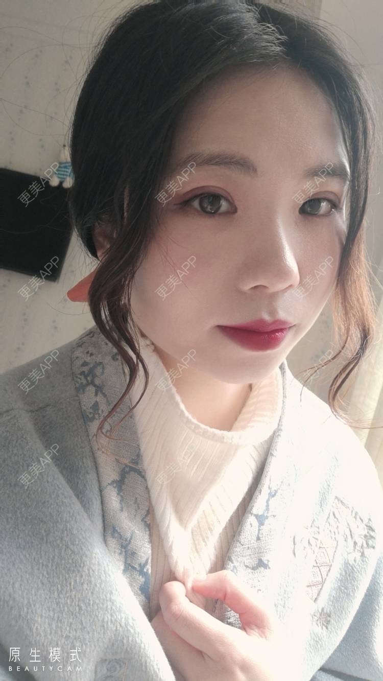 更美 - 墨七轩的双眼皮经验 | 双眼皮 | 全切双眼皮 | 开内眼角 | 开外眼角 | 杭州