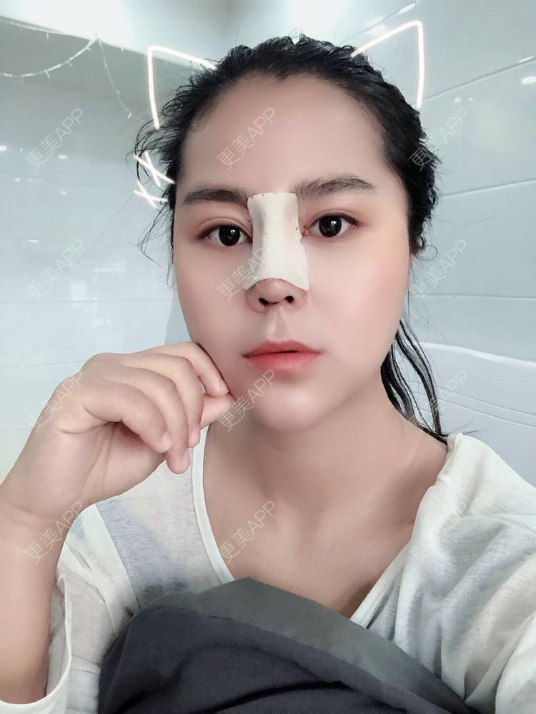 更美 - 更美用户zwQN5e8jIh的鼻部多项经验 | 鼻部多项 | 长沙