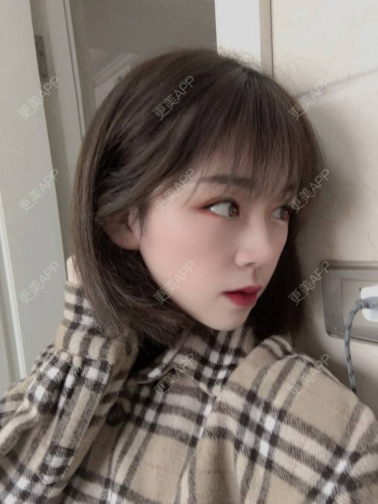 更美 - 小毛毛的夏天的全切双眼皮经验 | 视频日记 | 全切双眼皮 | 宜昌