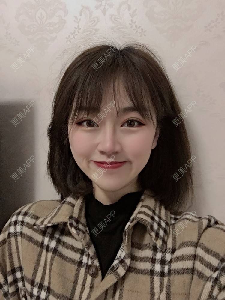 更美 - 小毛毛的夏天的全切双眼皮经验 | 视频日记 | 全切双眼皮 | 宜昌