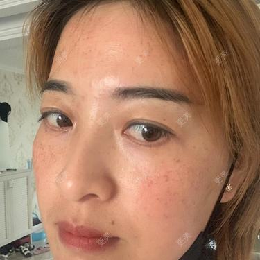 更美用户QLfshUHHH0