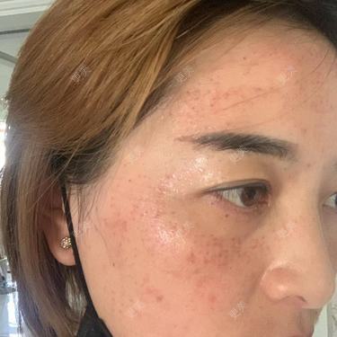 更美用户QLfshUHHH0