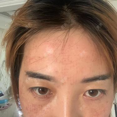 更美用户QLfshUHHH0