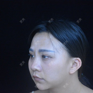 °·月亱相携林