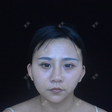 °·月亱相携林