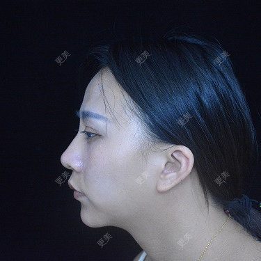 °·月亱相携林