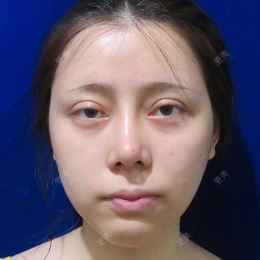 更美用户dntqxTUqa7