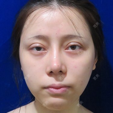 更美用户dntqxTUqa7