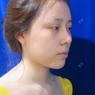 更美用户dntqxTUqa7