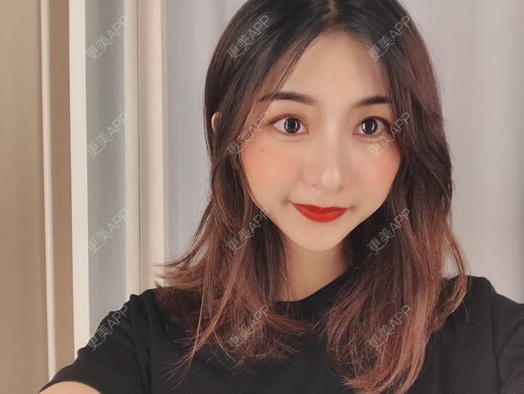 更美 - 更美用户h6811W70iO的鼻翼缩小经验 | 鼻翼缩小 | 人工骨隆鼻 | 真皮隆鼻 | 长鼻矫正 | 微晶瓷隆鼻 | 福州