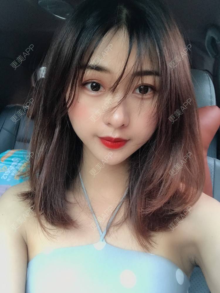 更美 - 更美用户h6811W70iO的鼻翼缩小经验 | 鼻翼缩小 | 人工骨隆鼻 | 真皮隆鼻 | 长鼻矫正 | 微晶瓷隆鼻 | 福州