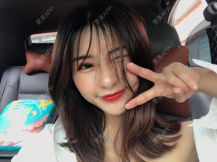更美 - 更美用户h6811W70iO的鼻翼缩小经验 | 鼻翼缩小 | 人工骨隆鼻 | 真皮隆鼻 | 长鼻矫正 | 微晶瓷隆鼻 | 福州