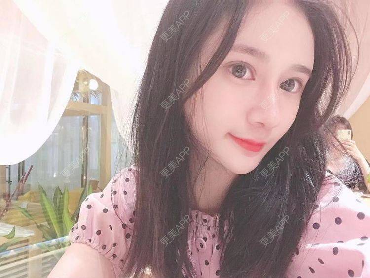 更美 - 江扳旧时月的洗眼线经验 | 北京 | 激光淡斑 | 皮秒激光 | 洗眼线