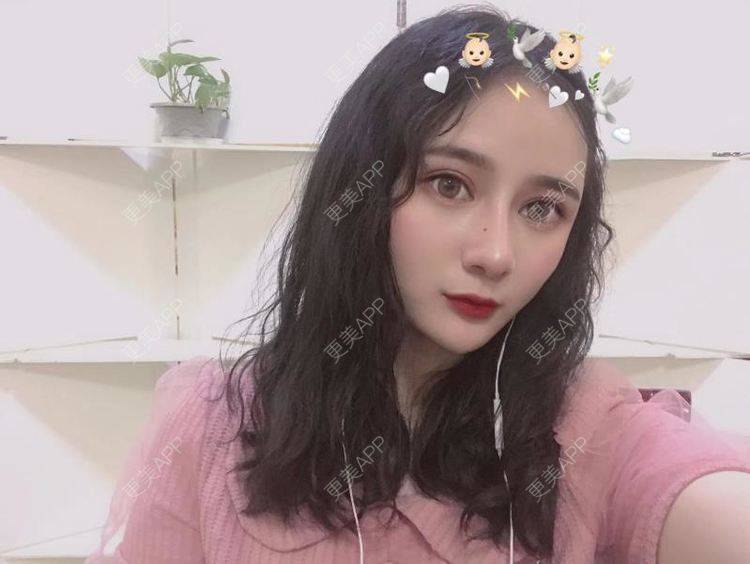 更美 - 江扳旧时月的洗眼线经验 | 北京 | 激光淡斑 | 皮秒激光 | 洗眼线