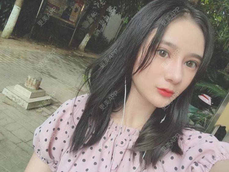更美 - 江扳旧时月的洗眼线经验 | 北京 | 激光淡斑 | 皮秒激光 | 洗眼线