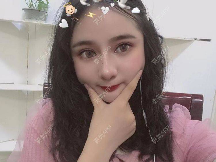 更美 - 江扳旧时月的洗眼线经验 | 北京 | 激光淡斑 | 皮秒激光 | 洗眼线