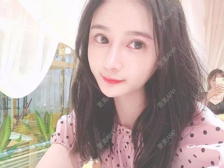 更美 - 江扳旧时月的洗眼线经验 | 北京 | 激光淡斑 | 皮秒激光 | 洗眼线