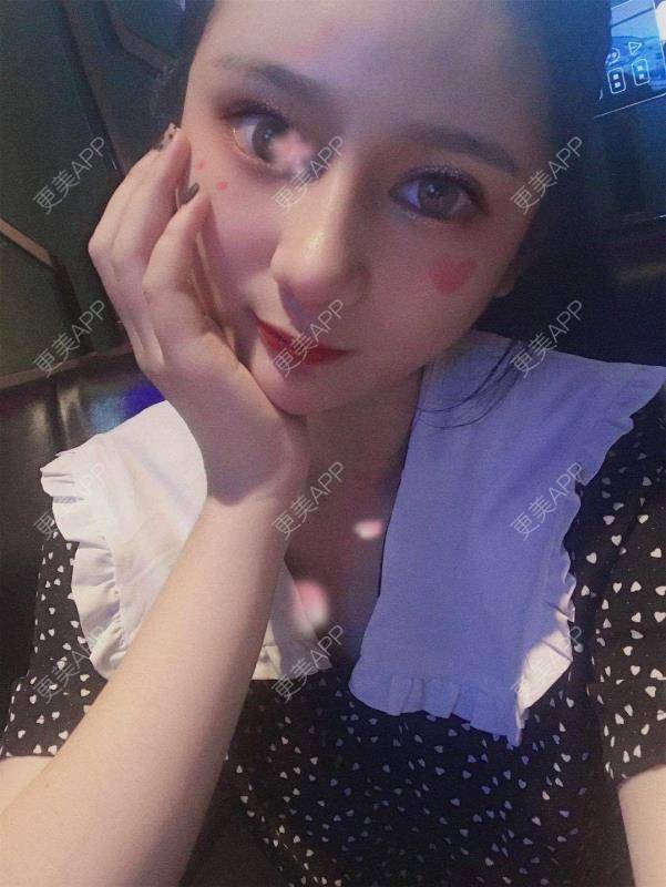 更美 - 江扳旧时月的洗眼线经验 | 北京 | 激光淡斑 | 皮秒激光 | 洗眼线