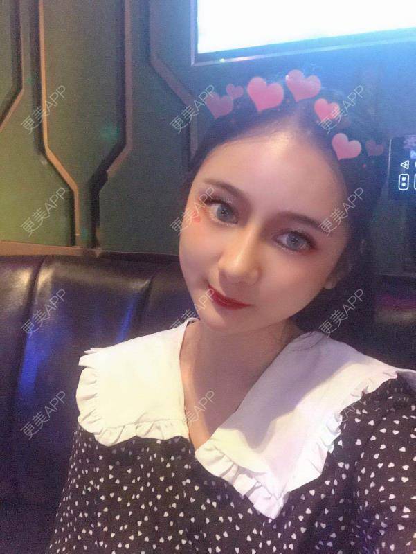 更美 - 江扳旧时月的洗眼线经验 | 北京 | 激光淡斑 | 皮秒激光 | 洗眼线