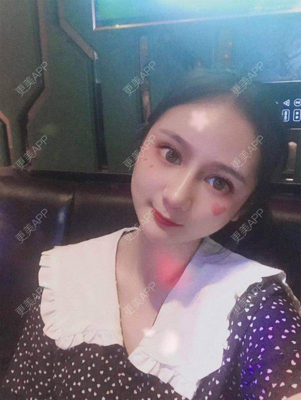 更美 - 江扳旧时月的洗眼线经验 | 北京 | 激光淡斑 | 皮秒激光 | 洗眼线