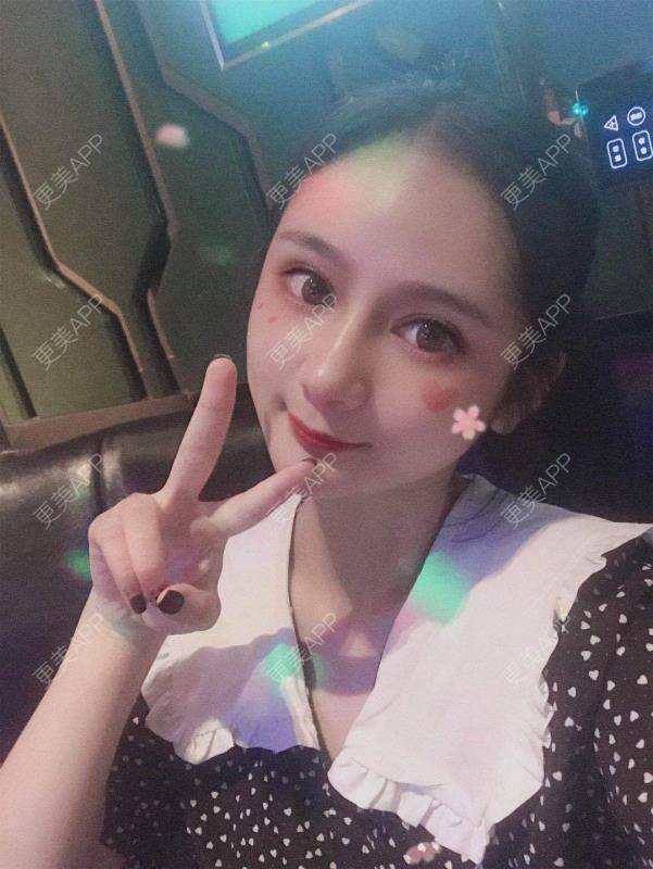 更美 - 江扳旧时月的洗眼线经验 | 北京 | 激光淡斑 | 皮秒激光 | 洗眼线