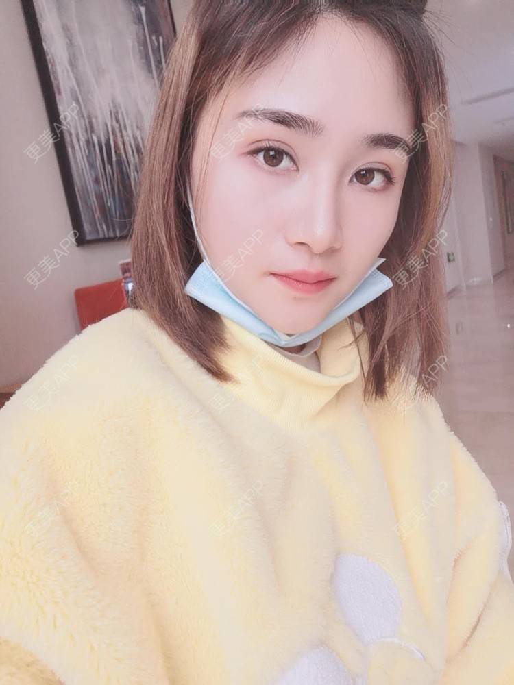 更美 - 小熊饼最爱的双眼皮修复经验 | 重庆 | 双眼皮修复